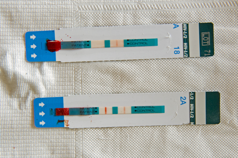 Rapid HIV test results: a visual line indicates <p>that the child is HIV positive